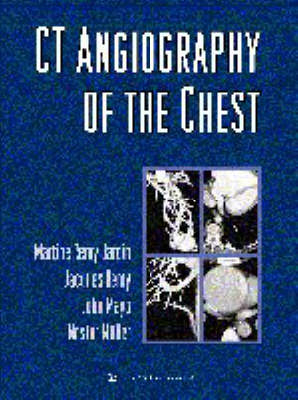 CT Angiography of the Chest - Martine Remy-Jardin, Jacques Remy, John R. Mayo, Nestor Luiz Muller