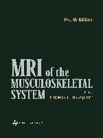 MRI of the Musculoskeletal System - Thomas H. Berquist