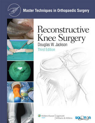Reconstructive Knee Surgery - 