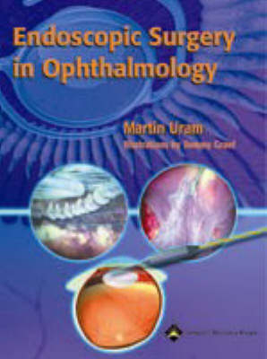 Endoscopic Surgery in Ophthalmology - Martin Uram