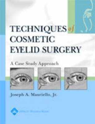 Techniques in Cosmetic Eyelid Surgery - 