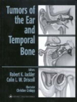 Tumors of the Ear and Temporal Bone - 