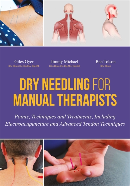 Dry Needling for Manual Therapists -  Giles Gyer,  Jimmy Michael,  Ben Tolson