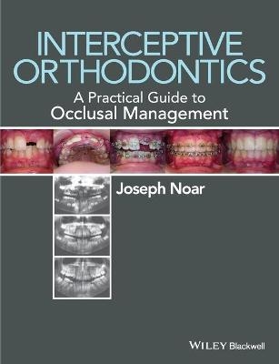 Interceptive Orthodontics - Joseph Noar