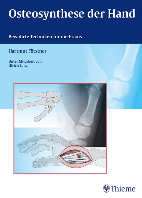 Osteosynthese der Hand - Hartmut Förstner