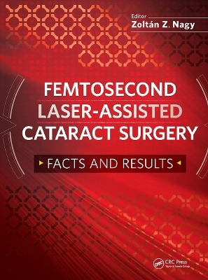 Femtosecond Laser-Assisted Cataract Surgery - Zoltan Nagy