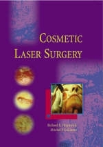Cosmetic Laser Surgery - Richard E. Fitzpatrick, Mitchel Goldman