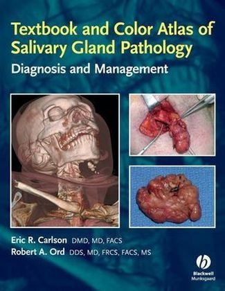 Textbook and Color Atlas of Salivary Gland Pathology - Eric Carlson, Robert Ord