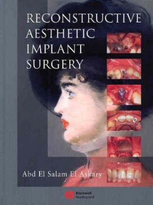 Reconstructive Aesthetic Implant Surgery -  Abd El Salam El Askary