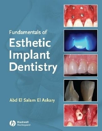 Fundamentals of Esthetic Implant Dentistry - Abdelsalam Elaskary