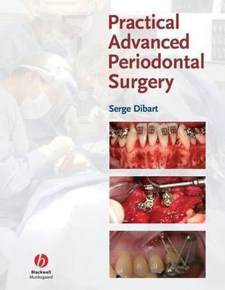 Practical Advanced Periodontal Surgery - Serge Dibart