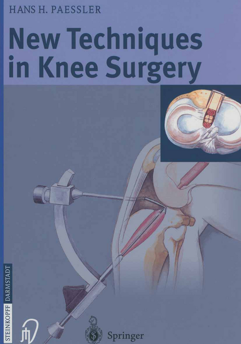 New Techniques in Knee Surgery - H.H. Paessler