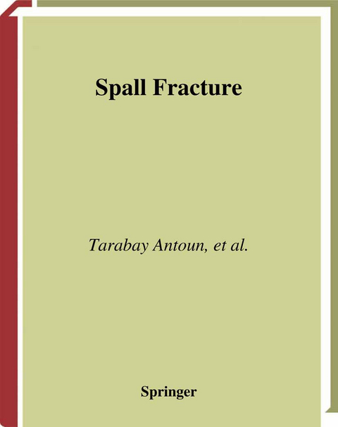 Spall Fracture - Tarabay Antoun, Lynn Seaman, Donald R Curran, Gennady I. Kanel, Sergey V. Razorenov