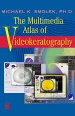 Multimedia Atlas of Videokeratography - Michael K. Smolek