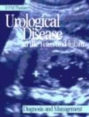 Urological Disease in the Fetus and Infant - D Thomas