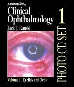 Clinical Ophthalmology - Jack J. Kanski