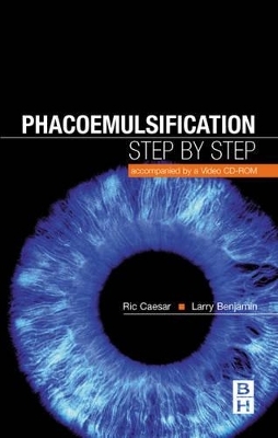 Phacoemulsification - Richard Caesar, Larry Benjamin