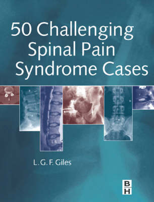 50 Challenging Spinal Pain Syndrome Cases - Lynton Giles