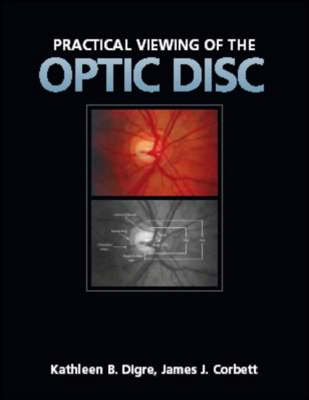 Practical Viewing of the Optic Disc - Kathleen B. Digre, James J. Corbett