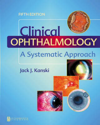 Clinical Ophthalmology - Jack J. Kanski