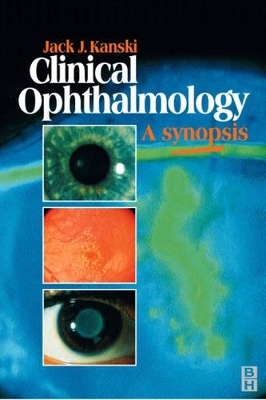 Clinical Ophthalmology - Jack J. Kanski, Anne Bolton