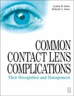 Common Contact Lens Complications - Lyndon Jones, Deborah Jones