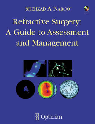 Refractive Surgery - Shehzad A. Naroo