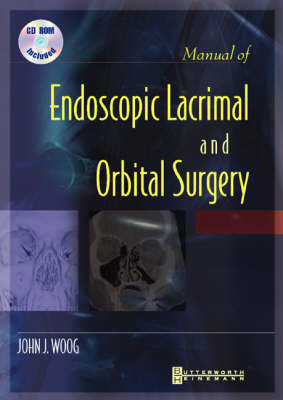 Manual of Endoscopic Lacrimal and Orbital Surgery - John J. Woog