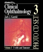 Clinical Ophthalmology - Jack J. Kanski