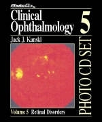 Clinical Ophthalmology - Jack J. Kanski