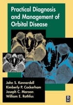 Practical Diagnosis and Management of Orbital Disease - 