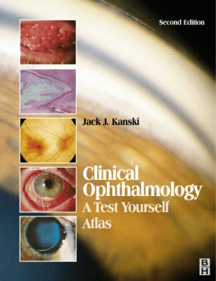 Clinical Ophthalmology - Jack J. Kanski