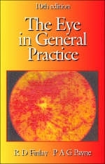 The Eye in General Practice - C.R.S. Jackson, R.D. Finlay, P.A.G. Payne