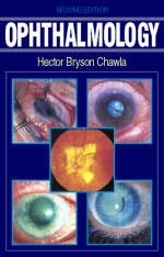 Ophthalmology - Hector Bryson Chawla