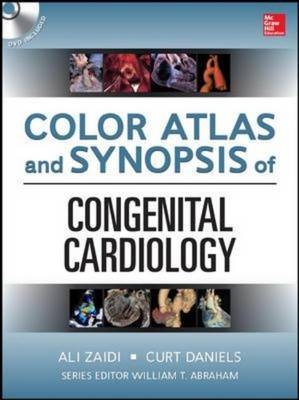 Color Atlas and Synopsis of Adult Congenital Heart Disease -  Curt Daniels,  Ali N. Zaidi