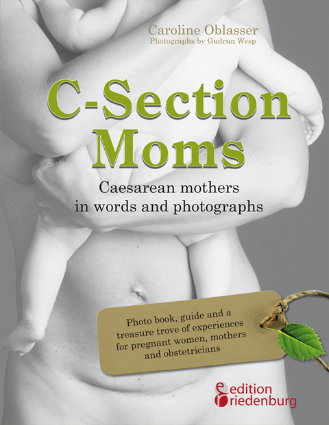 C-Section Moms - Caesarean mothers in words and photographs - Caroline Oblasser