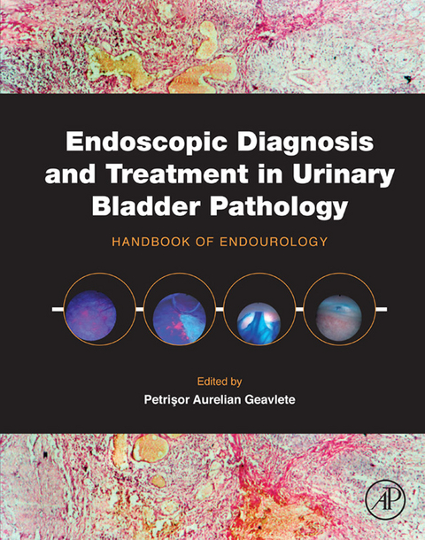 Endoscopic Diagnosis and Treatment in Urinary Bladder Pathology - 