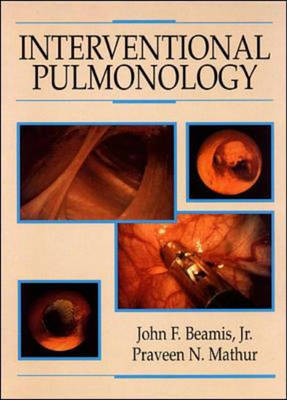 Interventional Pulmonology - John F. Beamis,  etc.