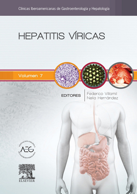 Hepatitis víricas - 