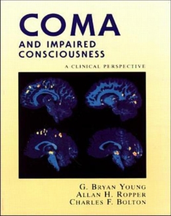 Coma and Impaired Consciousness: A Clinical Perspective - G. Young, Allan Ropper, Charles Bolton