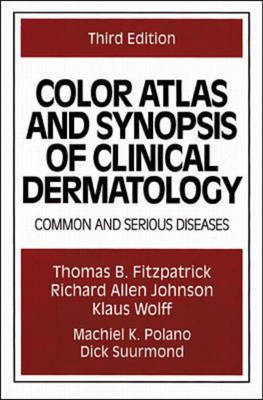 Color Atlas and Synopsis of Clinical Dermatology - 