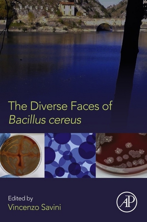 Diverse Faces of Bacillus Cereus - 
