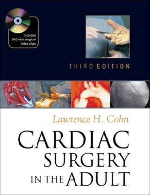 Cardiac Surgery in the Adult, Third Edition - Lawrence Cohn