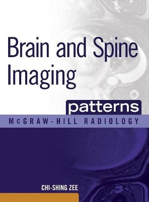 Brain and Spine Imaging Patterns - Chi-Shing Zee