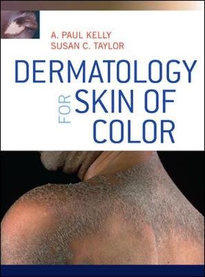 Dermatology for Skin of Color - A. Paul Kelly, Susan Taylor