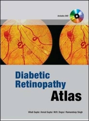 Diabetic Retinopathy Atlas - Vishali Gupta, Amod Gupta, M.R. Dogra, Ramandeep Singh