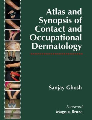 Atlas and Synopsis of Contact and Occupational Dermatology - Sanjay Ghosh