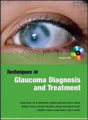 Techniques in Glaucoma Diagnosis and Treatment - Ashok Garg