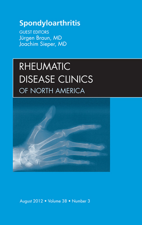 Spondyloarthropathies, An Issue of Rheumatic Disease Clinics -  Juergen Braun,  Joachim Sieper