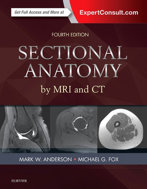 Sectional Anatomy by MRI and CT E-Book -  Mark W. Anderson,  Michael G Fox